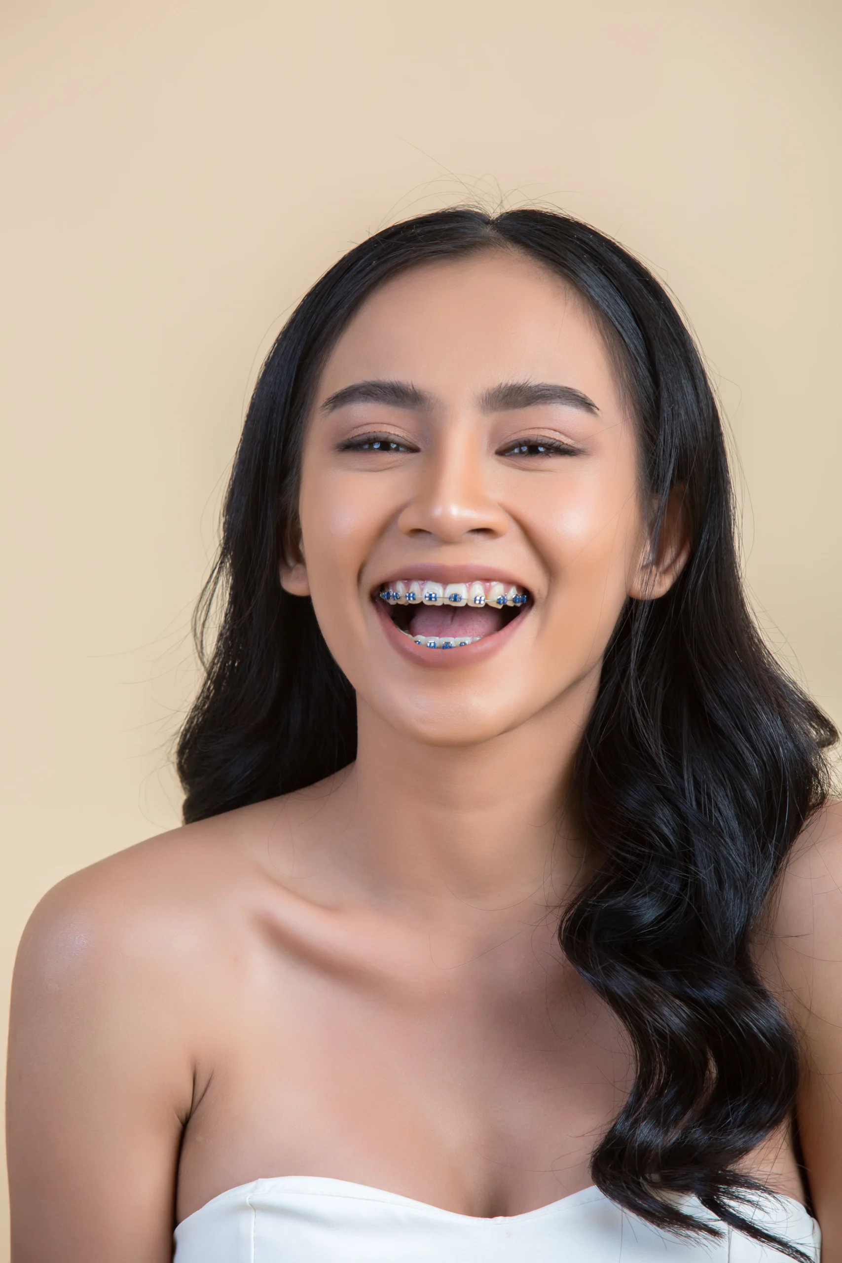 Clear Braces Comfort
