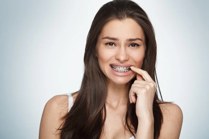 Clear Braces Effectiveness