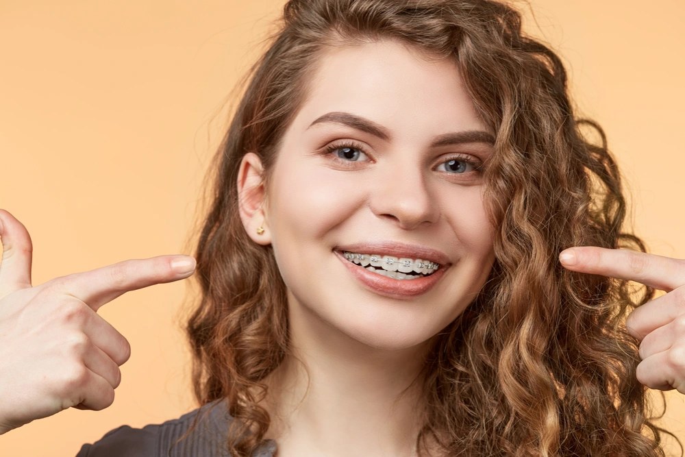 Clear Braces Cost